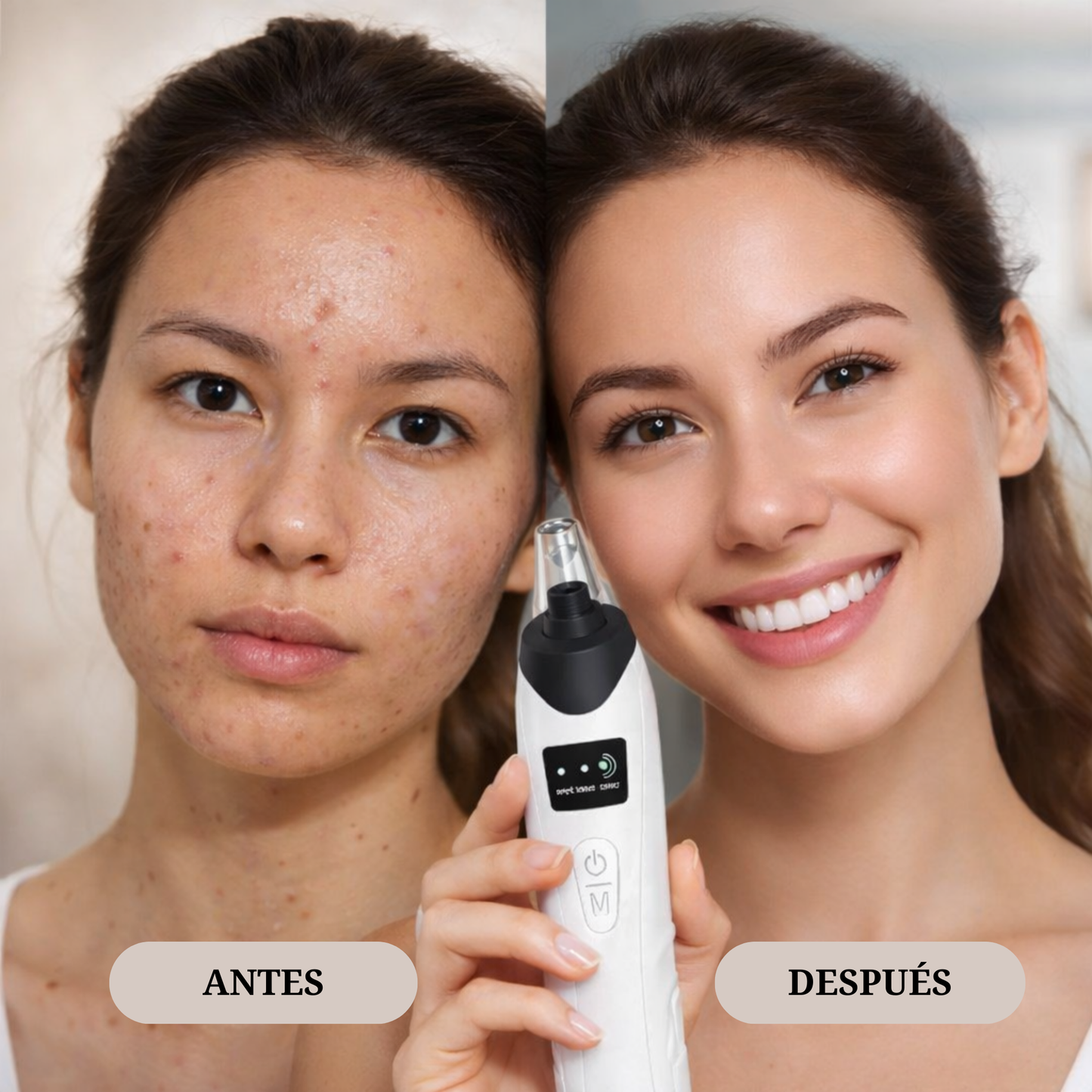 Limpiador facial con 5 cabezales